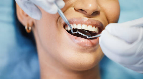Best Emergency Tooth Extraction in Nashville, IN